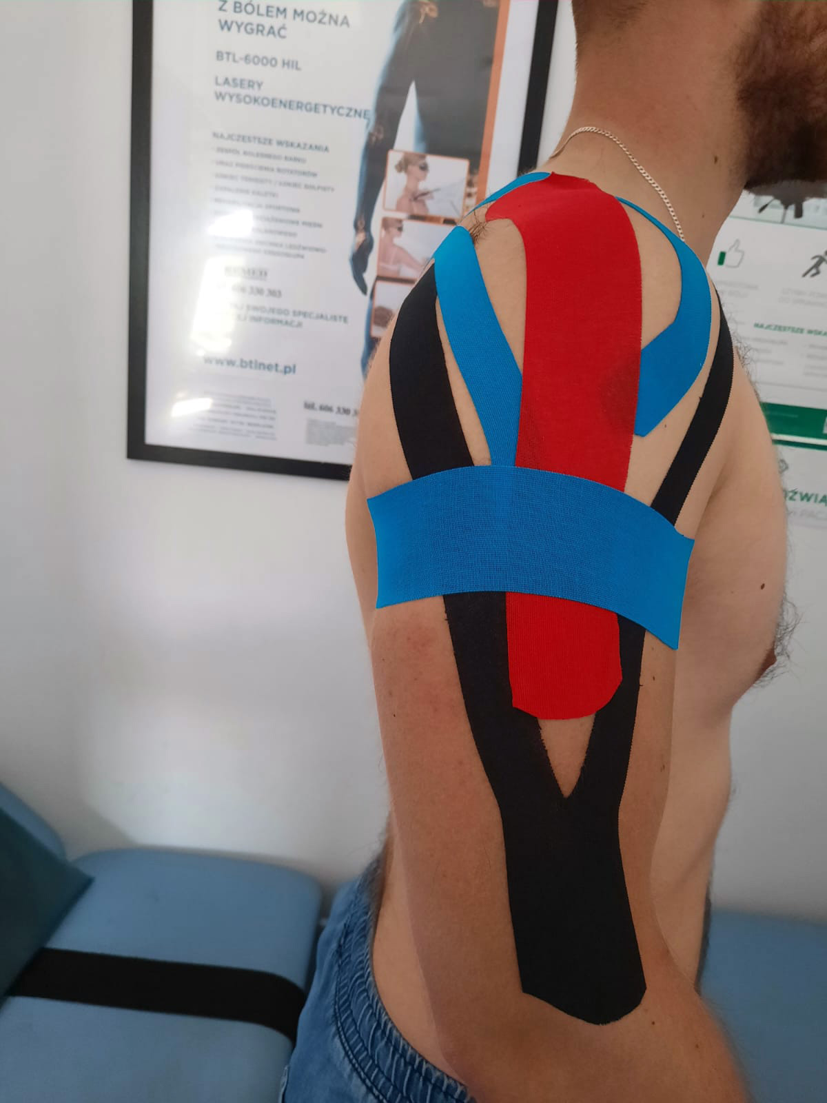 Kinesiotaping barku